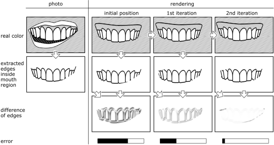 Method for aligning a three-dimensional model of a dentition of a patient to an image of the face of the patient recorded by a camera